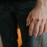 Detailed image of a hand with visible wounds and scratches, emphasizing injury.