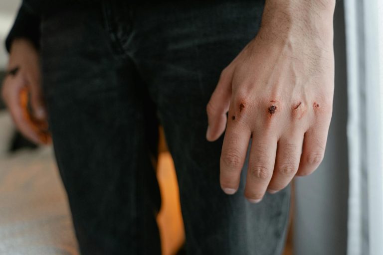 Detailed image of a hand with visible wounds and scratches, emphasizing injury.