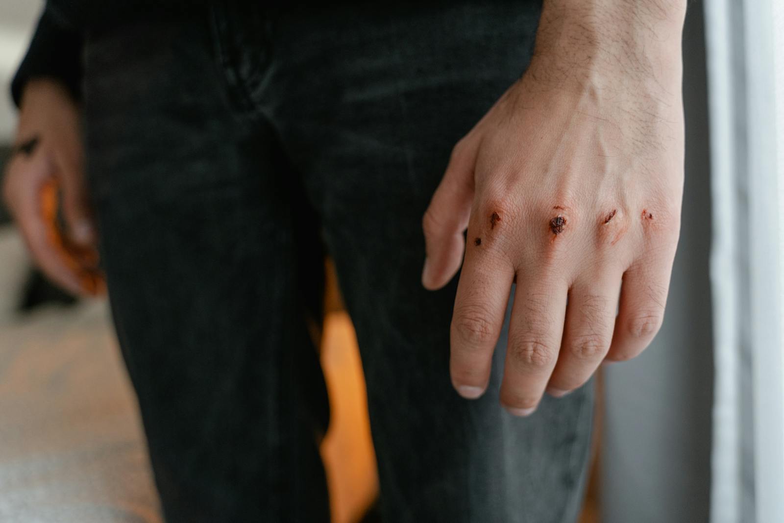 Detailed image of a hand with visible wounds and scratches, emphasizing injury.