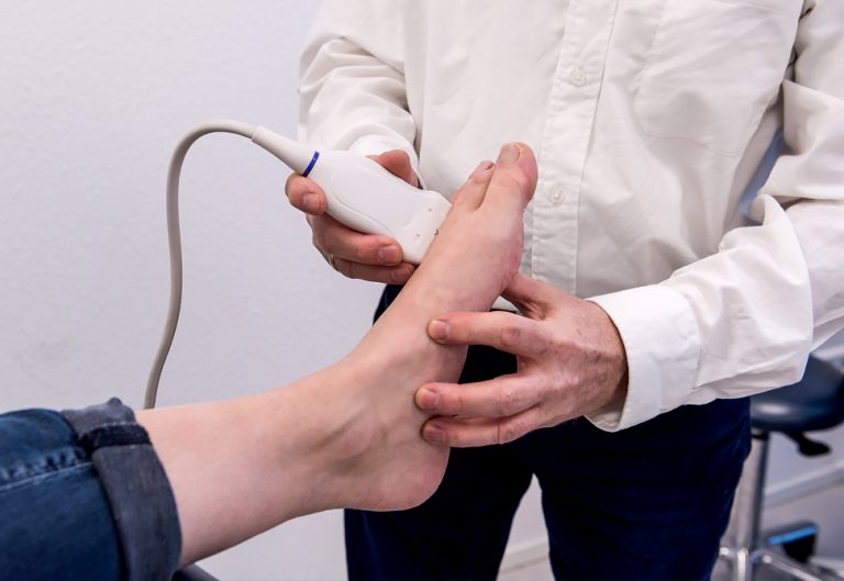 Vergoeding - Afbeelding